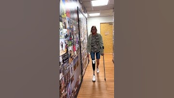 Christina a Below knee amputee, sharing her experience at A Step Ahead Prosthetics