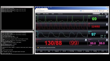 Heterogeneous Asymmetric Multiprocessing by Mentor Embedded