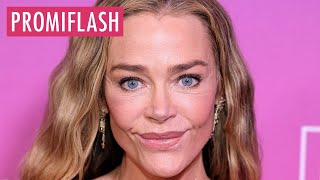Celebrity Wie ihre Tochter: Denise Richards präsentiert ihr Facelift Wealth