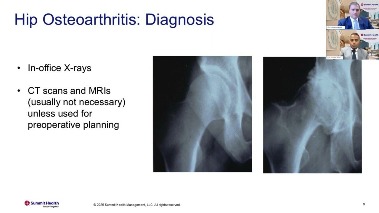 Возвращаемся к движению: ваше руководство по боли в бедре