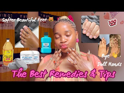How To Instantly Brighten & Get Rid of Dull, Hardened, Wrinkled Hands & Feet 💯| Hands & Foot Care🌷