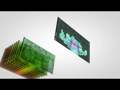 Cтоматологическая цифровая рентгеновская система VistaVox S 2D /3D, видео 1