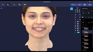2 RAYFace SW Patient Data Reorientation Guide screenshot 2