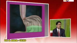MyHEALTH : GERD