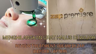 Urat Halus Pada Wajah Bisa Hilang Gak Sih?  | Pengalaman laser VBEAM di ZAP PREMIERE by Naomi Natalie  312 views 4 months ago 10 minutes, 28 seconds