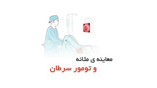 معاینه ی مثانه و تومور سرطان _ دکتر میرصادقی