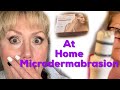 At home microdermabrasion.  Trophy Skin MicrodermMD.,  DIY how to get beautiful skin.