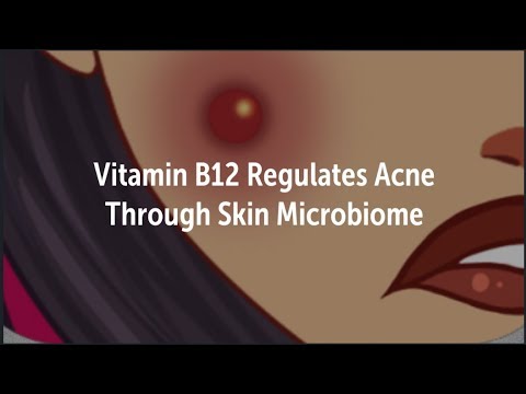 Vitamin B Regulates Acne with Skin Bacteria | Microbiome, Probiotic