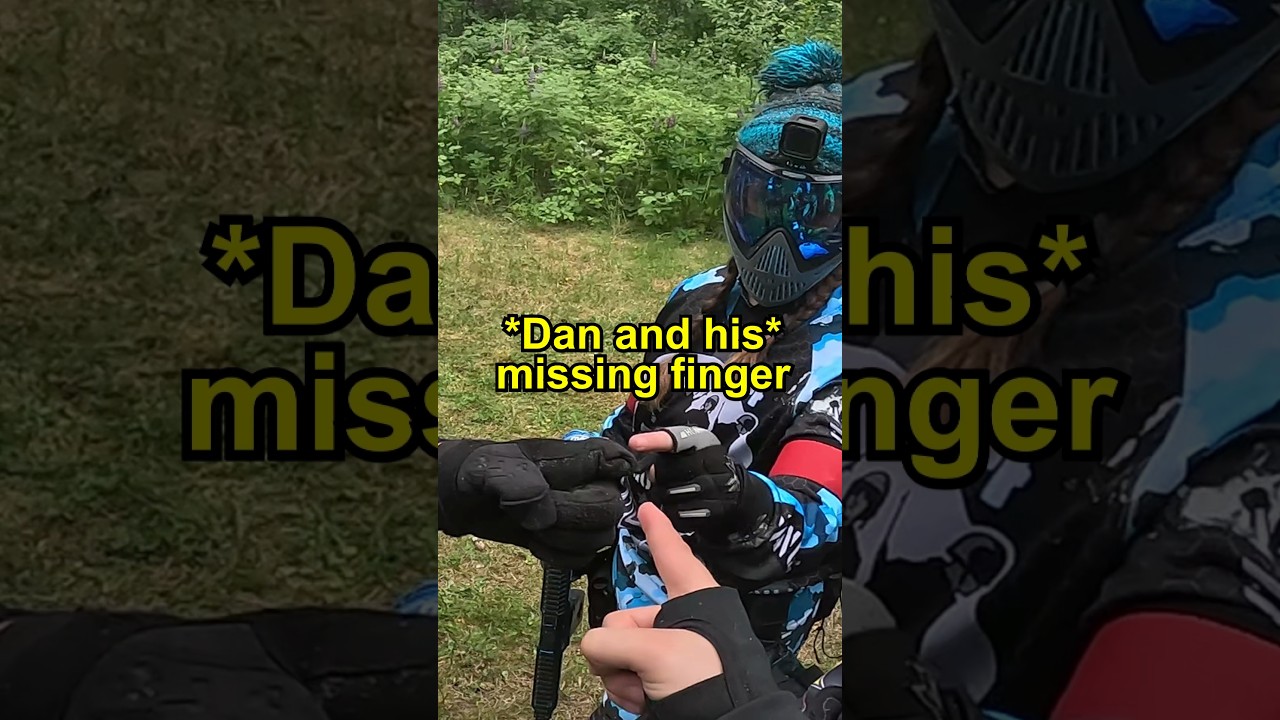Он ПОТЕРЯЛ ПАЛЬЦ во время игры в пейнтбол?😱