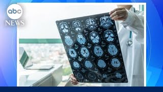 Blood test shows promising results in diagnosing Alzheimer’s disease