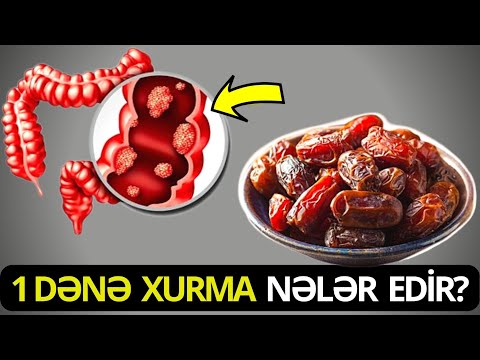 Video: Xurmaların boyu nə qədər olur?