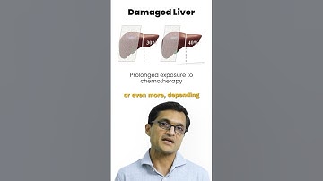 Future Liver Remnant: How Much is Enough and Measurement #livercancer #livercancertreatment #cancer