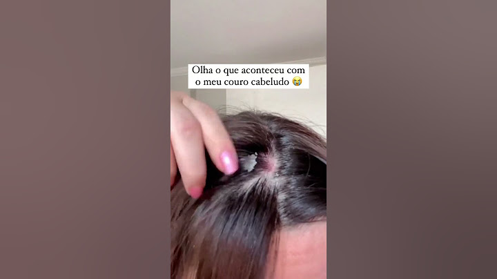 Olha o que aconteceu com o meu couro cabeludo 😭 #caspa #descamação #oleosidadecapilar