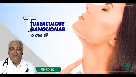 Como pega tuberculose ganglionar?