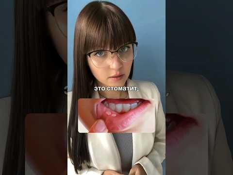 Как быстро вылечить стоматит! #лечениестоматита #стоматит #каклечитьстоматит