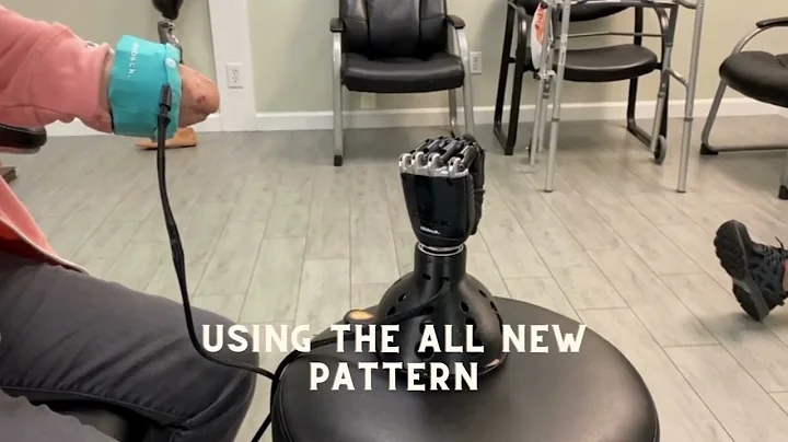 Otto Bock - Bebionic myoelectric hand using the all new pattern recognition control system