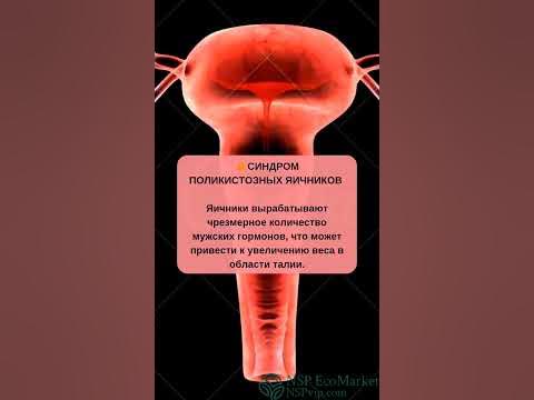 РЕЗКИЙ НАБОР ВЕСА - YouTube