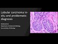 Lobular carcinoma in-situ and problematic diagnosis