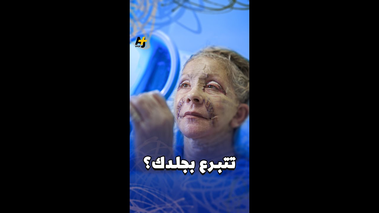 مصر تدرس إنشاء أول بنك وطني للأنسجة والجلد