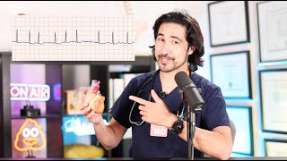 Is Your Heart Rate Too Fast?  Doctor Explains #health #fitness #atrialfibrillation