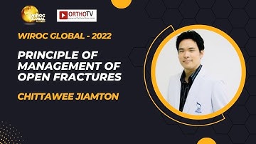 Wiroc Global 2022 : Principle of Management of Open Fractures - Chittawee Jiamton