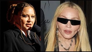 MADONNA Rumors- Did Madonna Fake Illness to get Cosmetic face Surgery fixed or Remove Butt Implants?