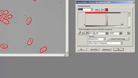 ImagePro Plus: Phase microscopy counting