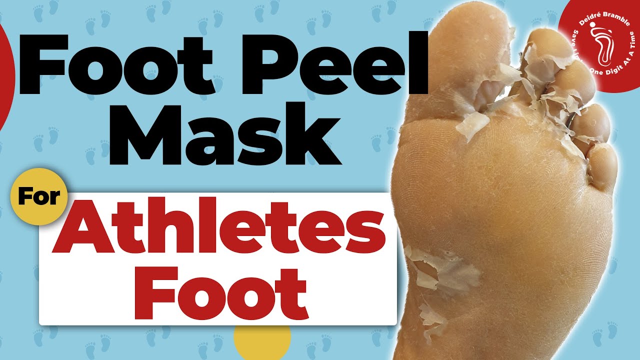 Foot Peel Mask Treatment For Athlete's Foot YouTube