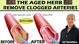 THE AGED HERB...REMOVE CLOGGED ARTERIES, LOWER CHOLESTEROL & BLOOD PRESSURE - Dr Alan Mandell, DC screenshot 4