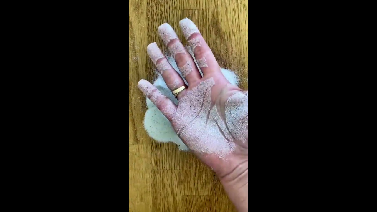  Hypersensitivity Excessive Sweating
