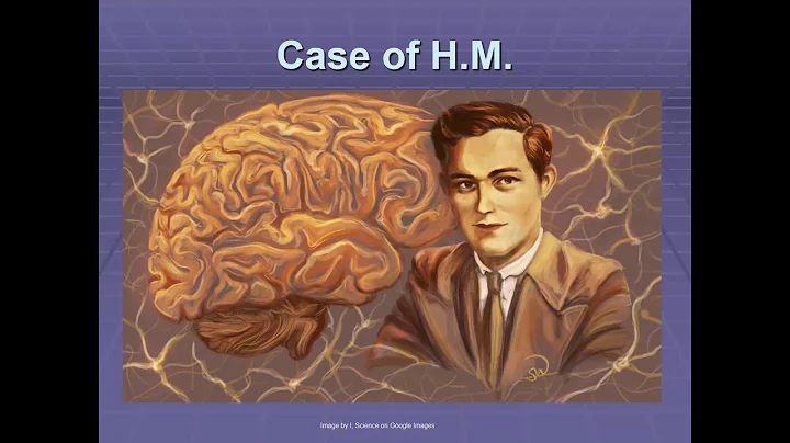 Introduction to Amnesia