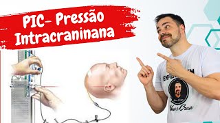 Pressão Intracraniana - Pic O Que Preciso Realmente Saber