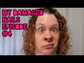 My Damaged Nails!!! Episode #4