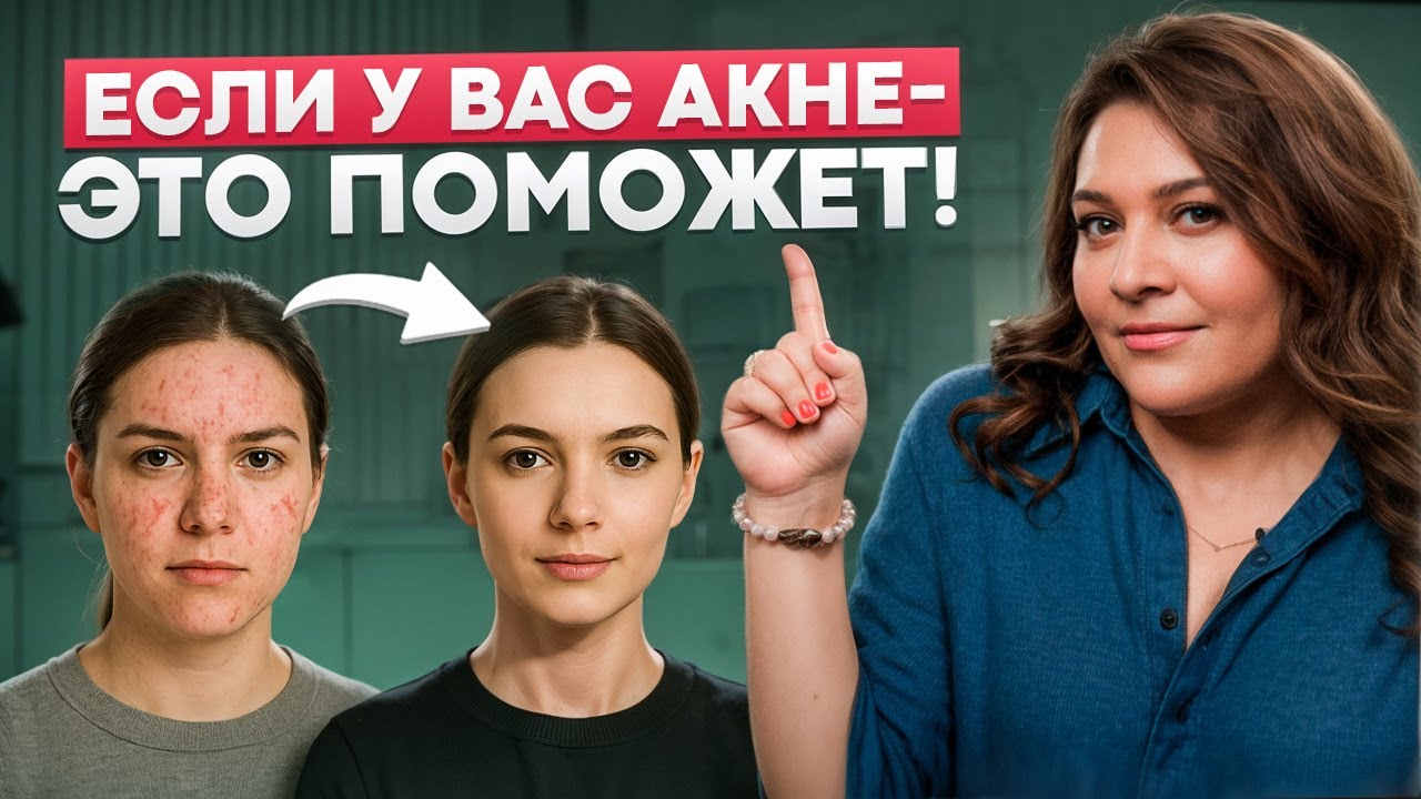 Самое эффективное средство против АКНЕ в 2025! Вот что скрывают косметологи!