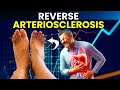 #1 Food To REVERSE Arteriosclerosis, Blood Clots &amp; Clogged Arteries