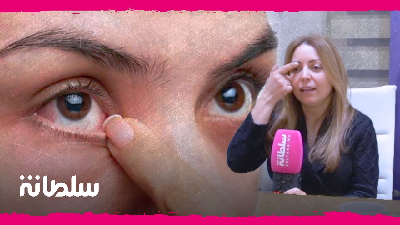 صحتك سلطانة: ترهل جلد الجفون ماهي الأسباب وطرق العلاج؟ جراحة التجميل جميلة أطناز تجيبك