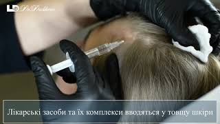 Мезотерапия кожи головы - избавиться от выпадения волос Мезотерапія шкіри голови
