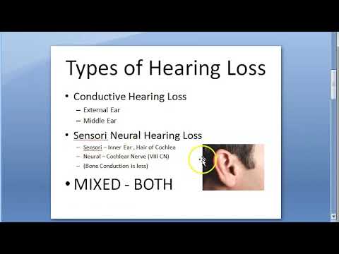 Types of Hearing Loss