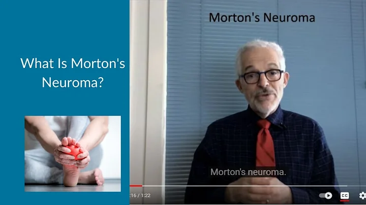 What is Morton's Neuroma?