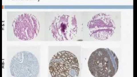 Statistical Learning without Ground Truth in Computer Vision and Medicine