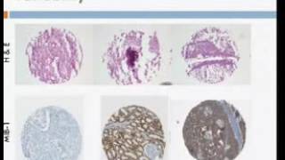 Statistical Learning without Ground Truth in Computer Vision and Medicine