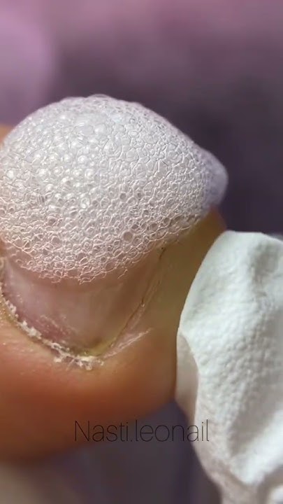 Педикюр/ ногти / #pedicure #ногти #skincare #педикюр - YouTube