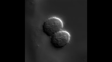 HeLa cell mitosis
