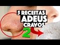 REMOVENDO CRAVOS DO NARIZ EM MINUTOS #4 - TÉCNICAS CASEIRAS QUE FUNCIONAM | KIM ROSACUCA