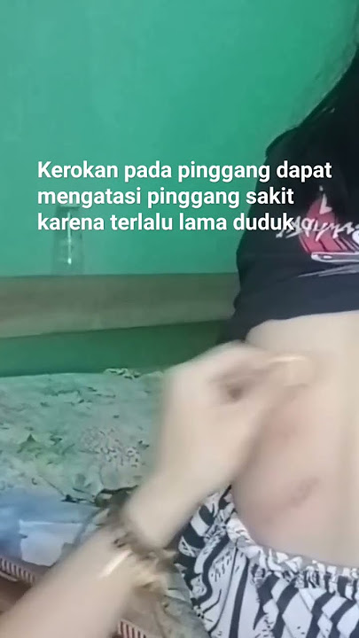 kerokan istri Indonesia#shorts