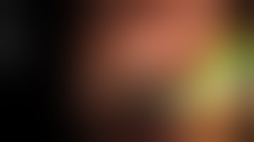 Cholangioscopy and Lithotripsy of Common bile duct stone