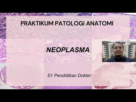 Video: Di mana neoplasma mesenkim?