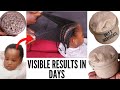 No Single Hair Strand Will Fall After Using This Treatment: Unstopable Hair Growth Fast