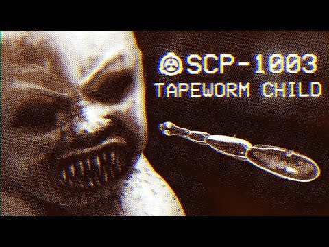 SCP-1003 - Tapeworm Child : Object Class - Keter :  Parasitic SCP