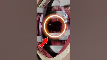 VÌ SAO PHẢI MỞ KHÍ QUẢN | 😨 (Bạn Biết Không) #thaukinhtrithuc #facts #amazingfact